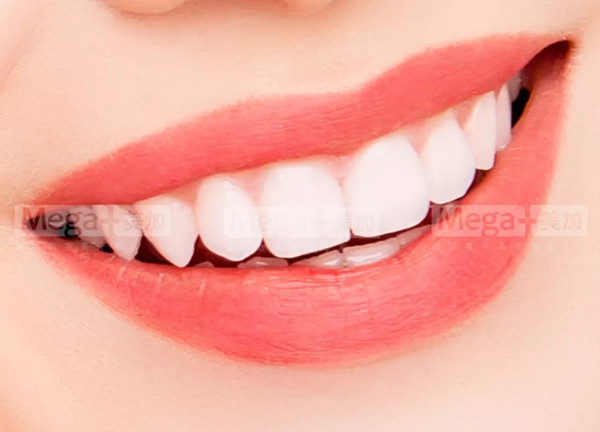 牙齿矫正的八大好处你知道吗？