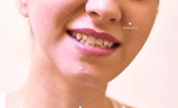 美加易齐微矫正：只有牙齿严重不齐才想起做牙齿矫正？