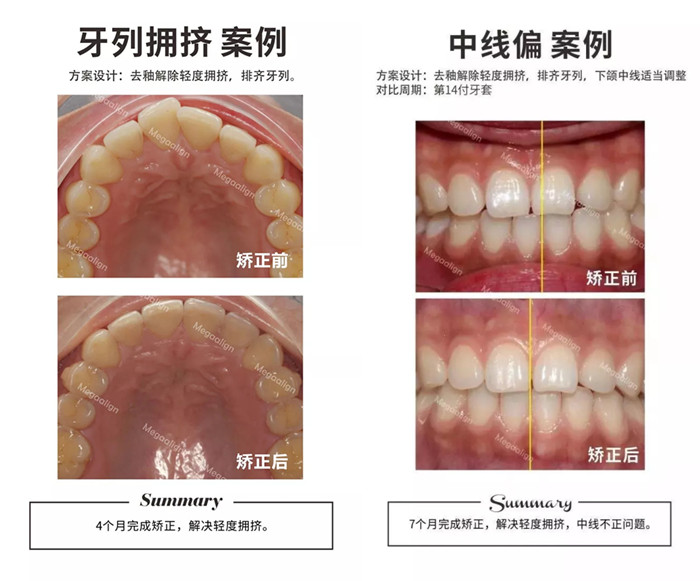 易齐微矫案例赏析