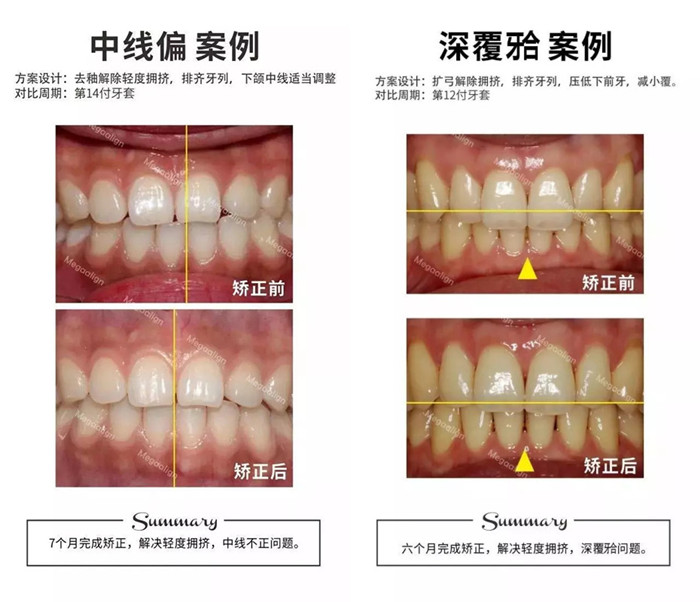 易齐微矫案例