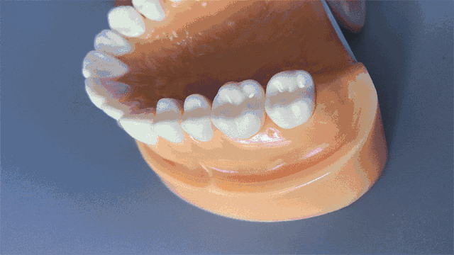 美加易齐微矫，让你的牙齿不仅美了还更健康！