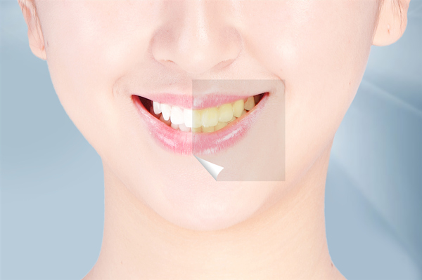 又被说牙黄了？这6大原因导致你的牙齿发黄