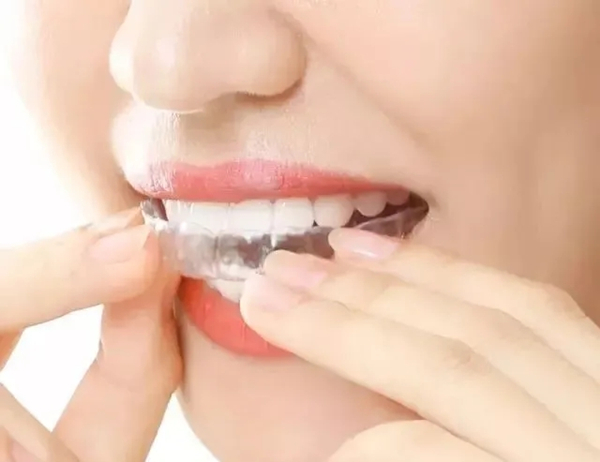 牙齿矫正后反弹是为什么？该怎么办？
