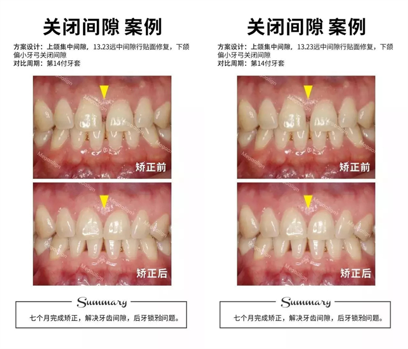 易齐微矫案例